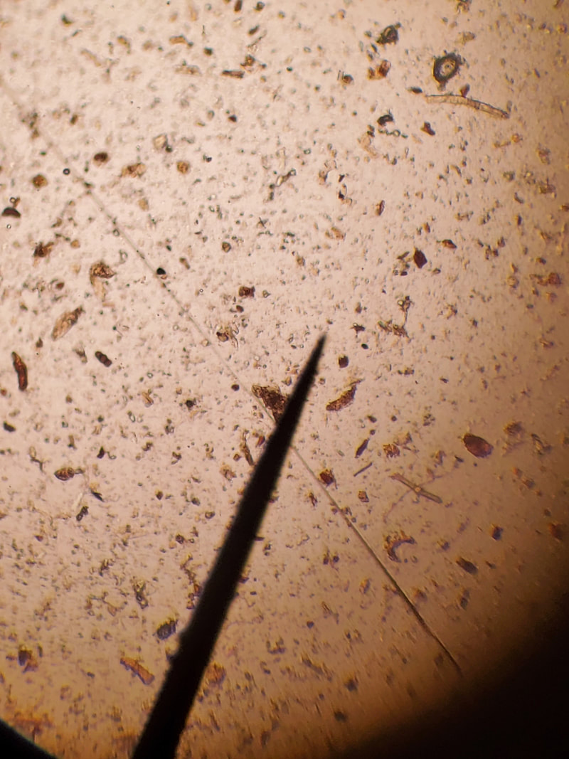 Compost Tea Under 400x Magnification, Showing Fungal Hyphae (long strand)