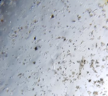 40x magnification of nematodes, mobile and non-mobile bacteria, flagellates, ciliates, among others.